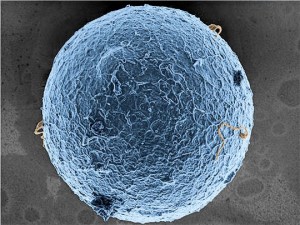 Fécondation d'un ovule par spermatozoides