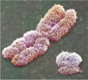 Le test du chromosome X permet à deux soeurs confirmer leur biologique même en son absence