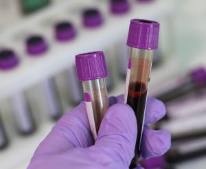 Test génétique non invasif par prélèvement sanguin